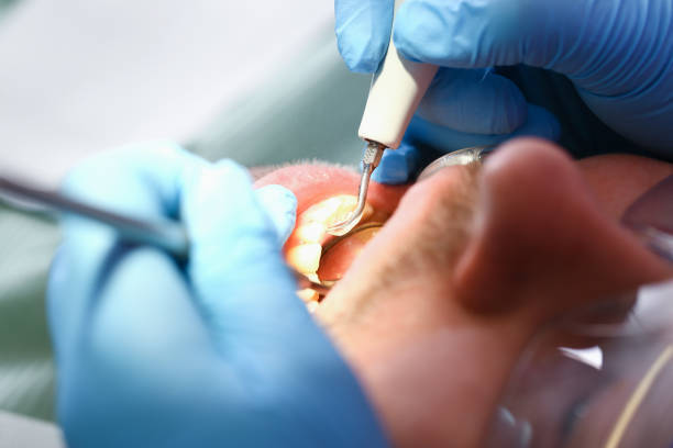 Best Tooth Pain Emergency Relief  in Bainbridge, GA